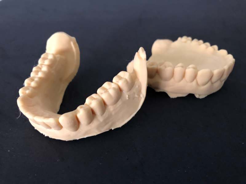 Esempio Stampa 3d dentale