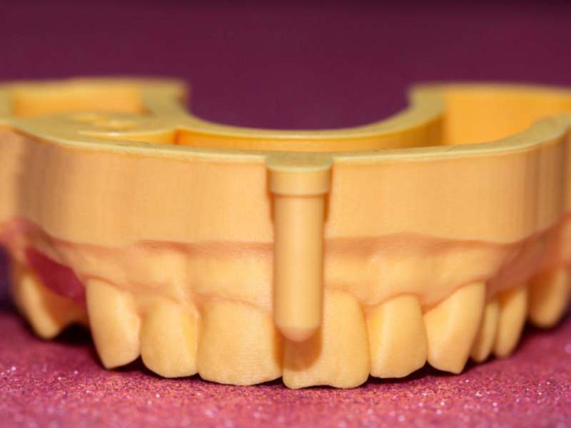 Esempio Stampa 3d dentale
